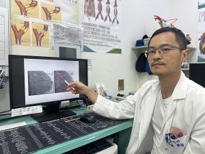 A流奪命危機 七旬翁併發心肌梗塞陷休克