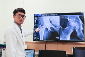 台中慈院關節中心保髖戰 減壓手術改善疼痛