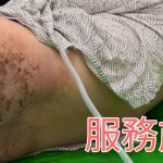 從厚重皮屑到清爽肌膚，創世助失能臥床者找回尊嚴