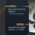 腳踏地如針扎、站不起！六旬男腰椎術後痛2年 MRI揪假性囊腫作祟
